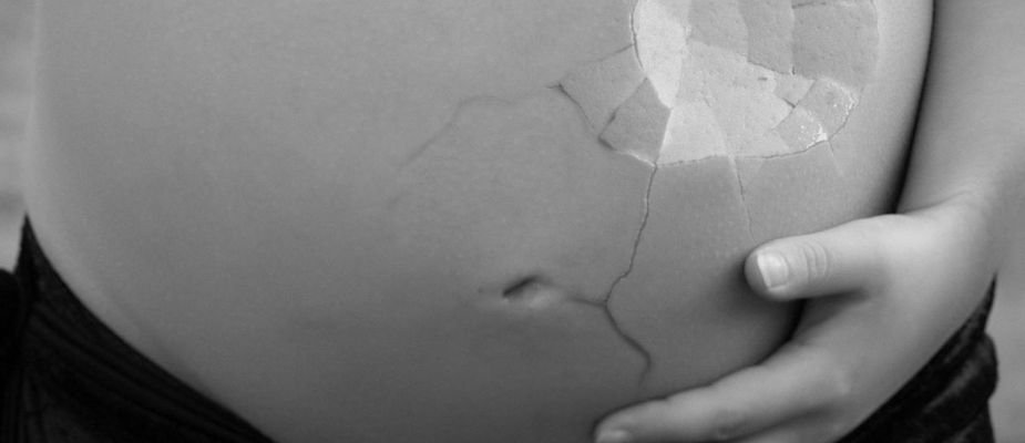 Sonhar com aborto: Molekada