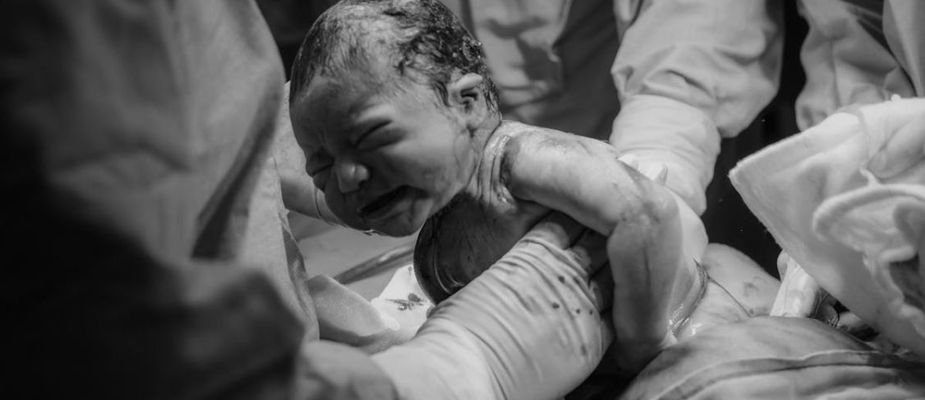 Sonhar com parto - Molekada!