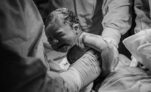 bebe em parto